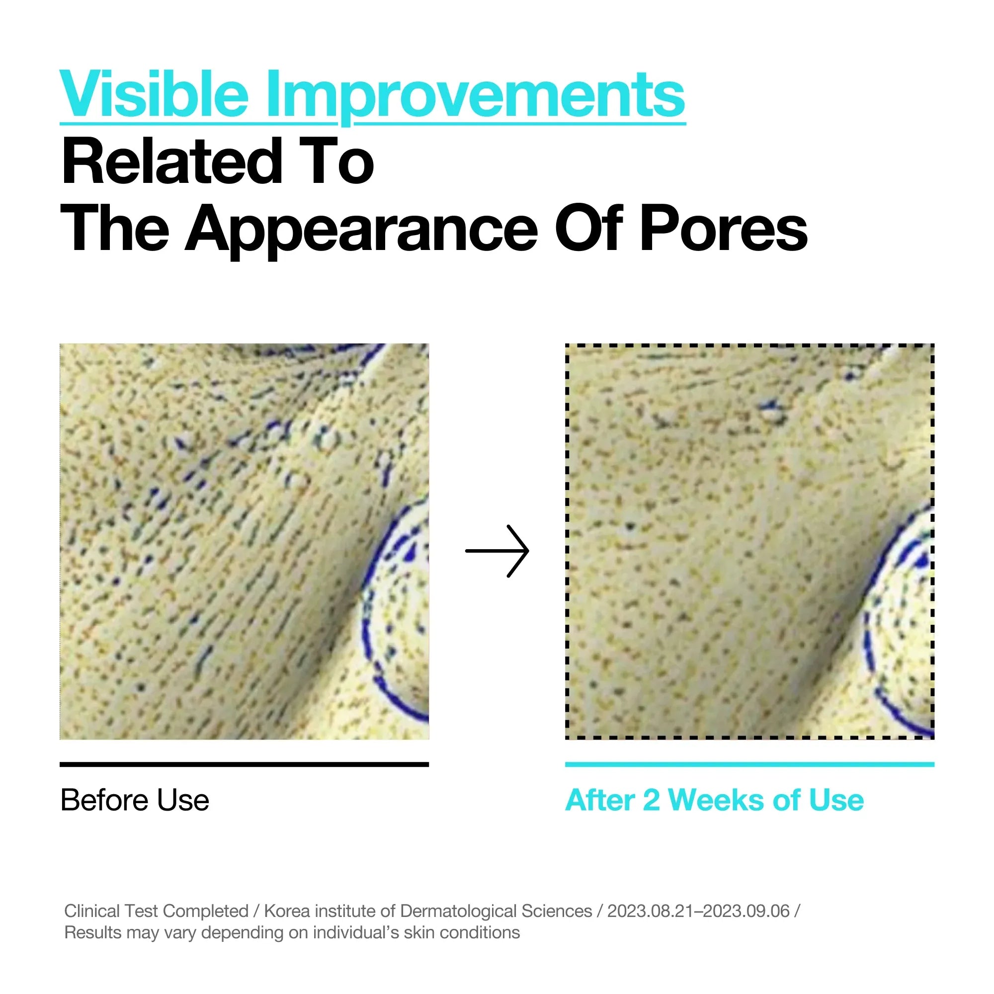 انوا تونر تقشير لطيف BHA 2% (150 مل)