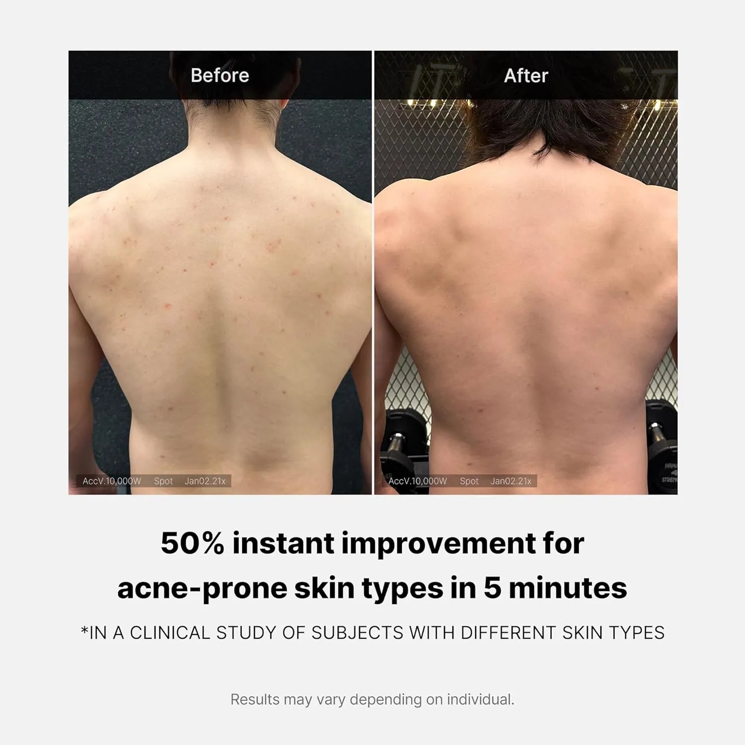 MEDICUBE Red Acne Body Wash