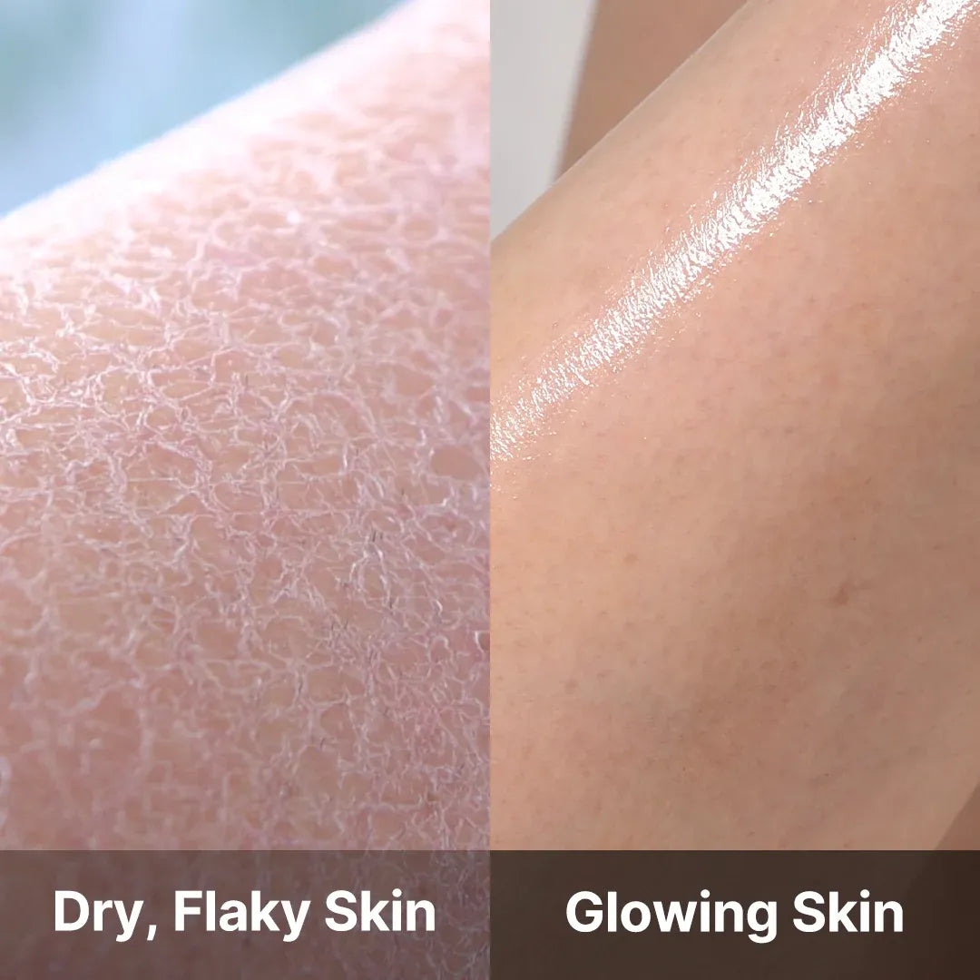 MEDICUBE Red Acne Body Wash