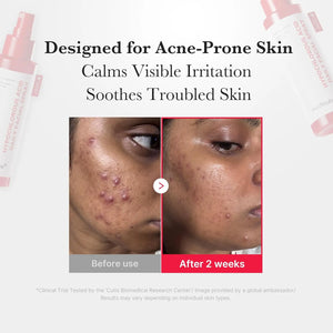 Medicube Power Soothing Spray Hypochlorous Acid product image – calming facial mist – Beutista